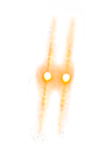 laser beam eyes